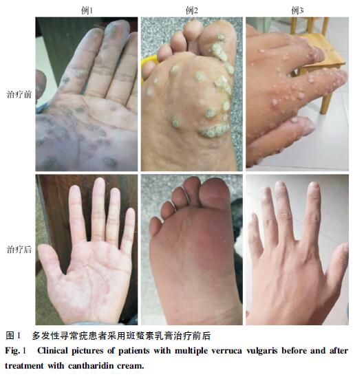 Clinical pictures